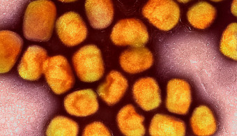 Des données scientifiques gratuites sur la variole du singe
